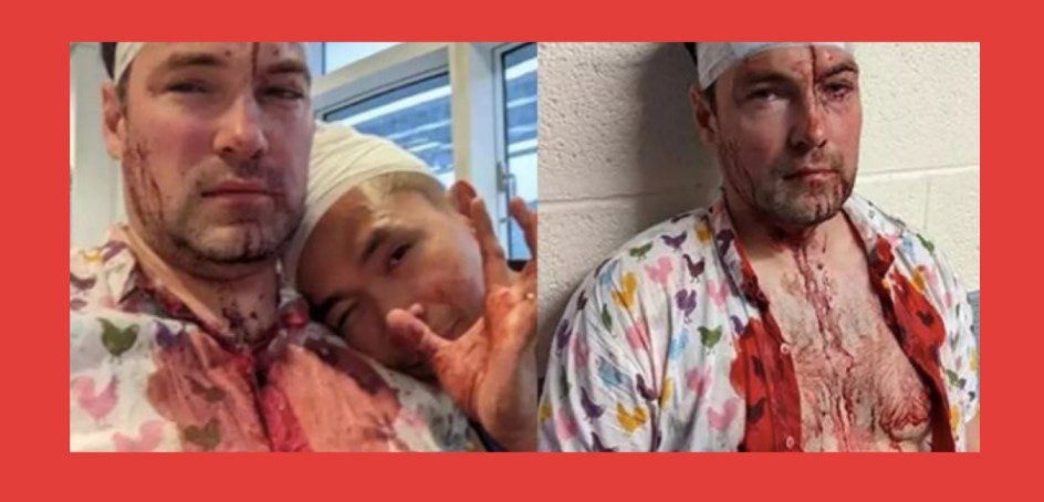 Gay Couple Left Bloodied After A Brutal Homophobic Attack In Birmingham