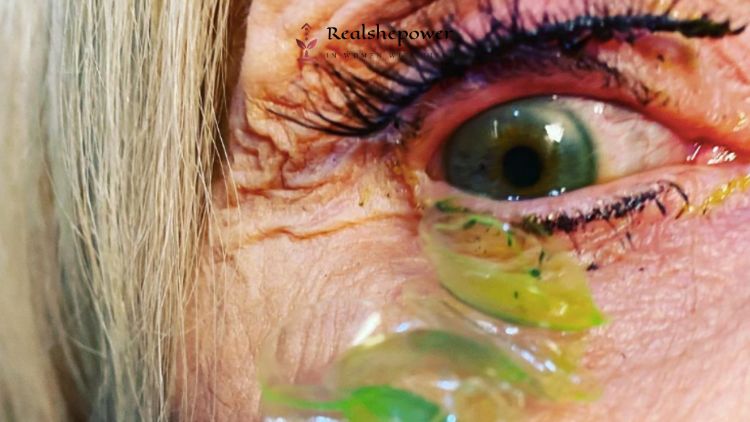 Scary Video: Doctor Removing 23 Contact Lenses From The Patient’S Eye