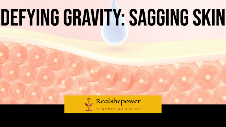 Defying Gravity: Sagging Skin
