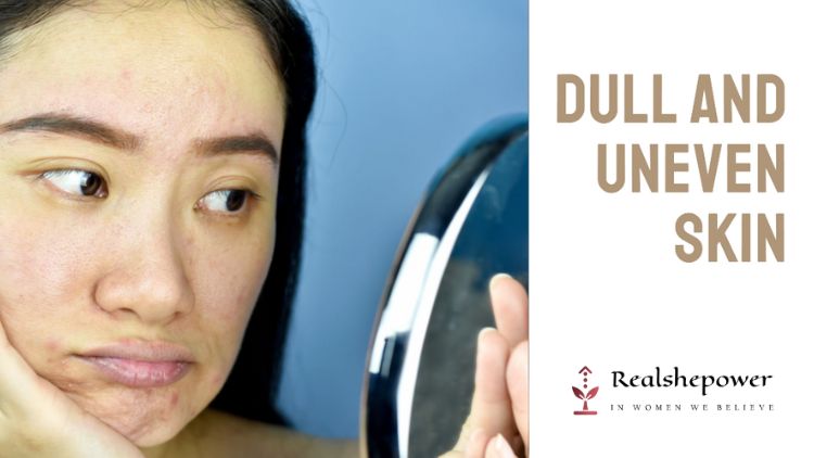 The Fading Glow: Dull And Uneven Skin
