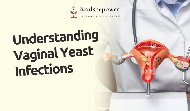 Understanding Vaginal Yeast Infections: A Common Women’S Health Concern