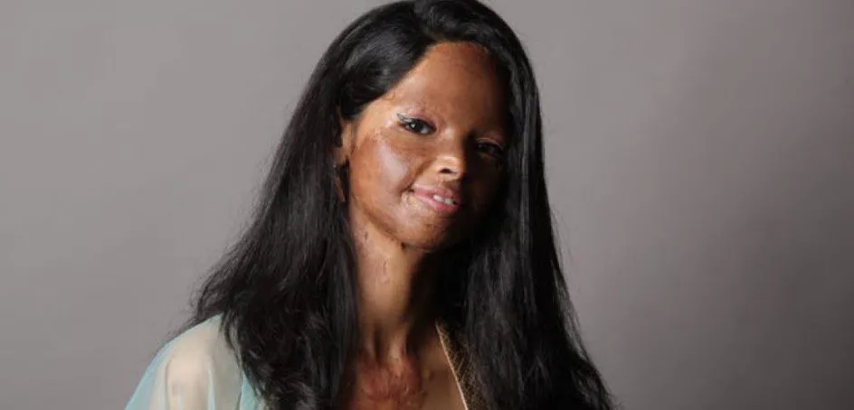 Acid Attack Survivors