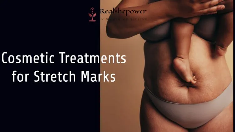 Cosmetic Treatments For Stretch Marks: Are They Worth The Investment? 1 Cosmetic Treatments For Stretch Marks: Are They Worth The Investment?