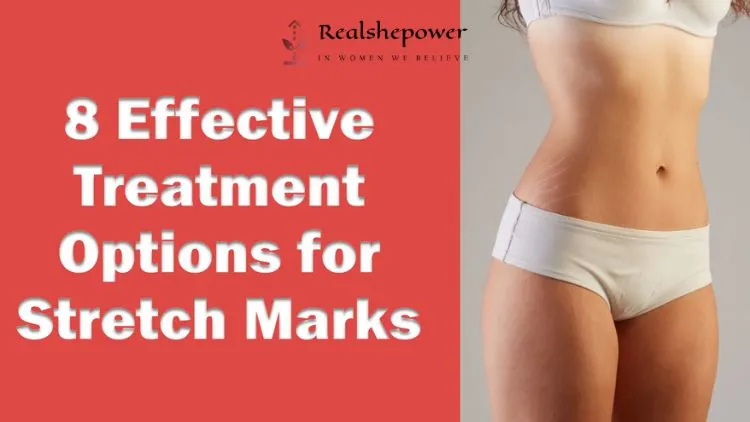 Understanding Stretch Marks: Causes, Prevention, And Treatment Options 2 8 Effective Treatment Options For Stretch Marks: Say Goodbye To Insecurities