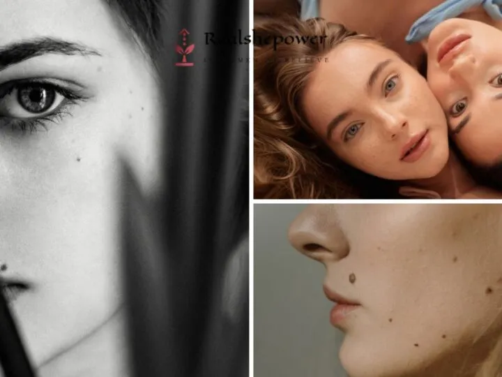 The Fascinating World Of Face Moles: What Do Those Little Dots Mean?