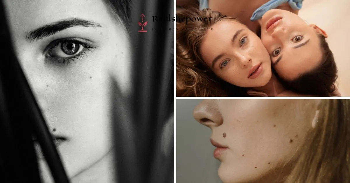 Face Moles: What Do Those Little Dots Mean?